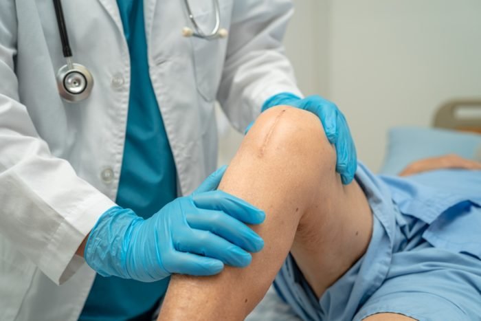 How Many Hours Is A Knee Replacement Surgery?