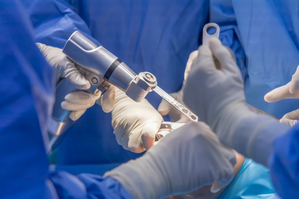 How Many Knee Replacements Can You Have In A Lifetime?
